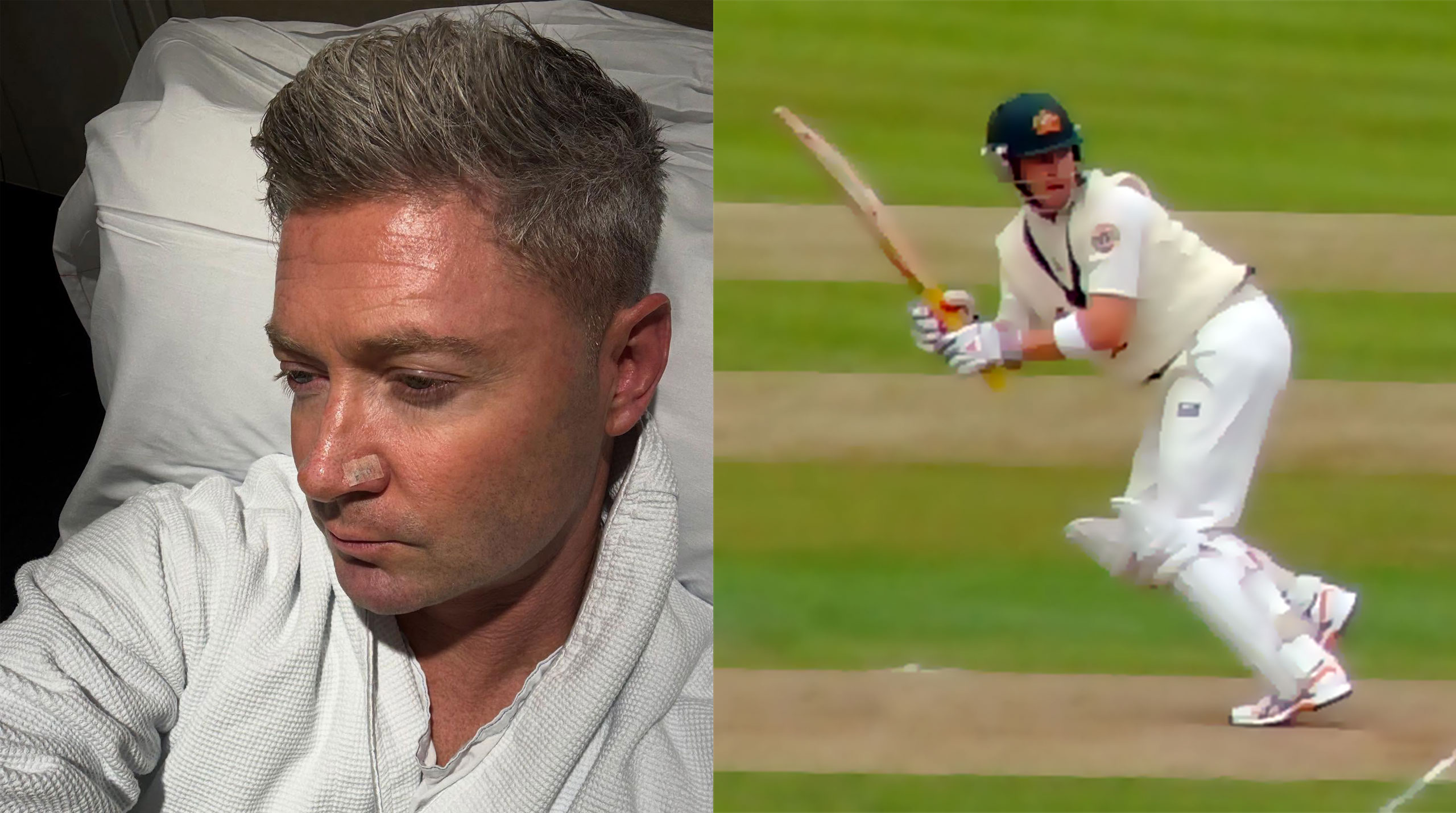 Former Aussie Skipper Michael Clarke Battles Skin Cancer